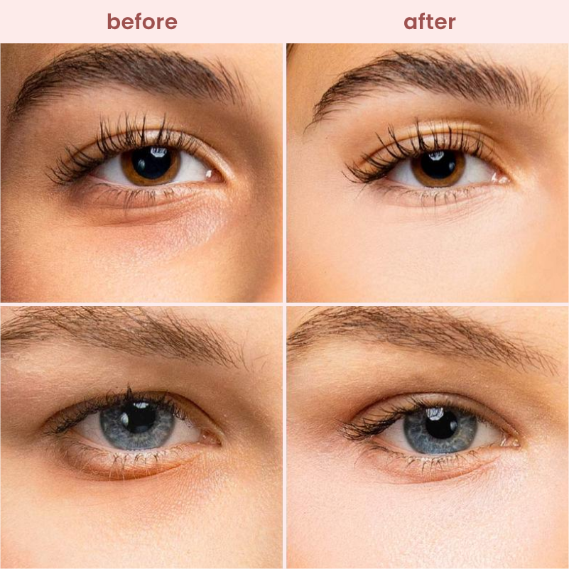 under eye brightener