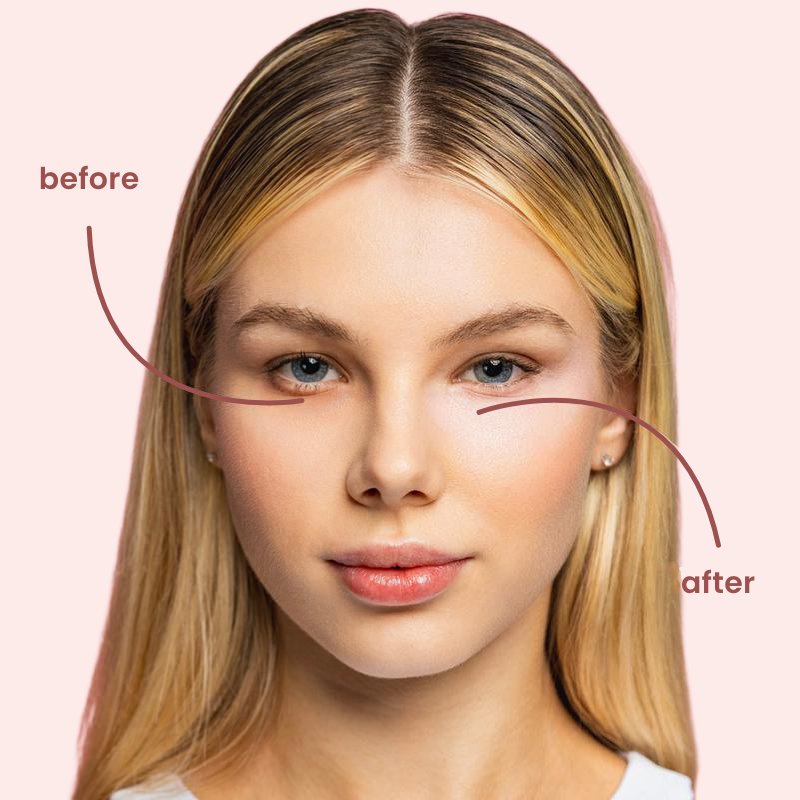 under eye brightener